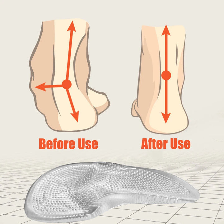 Orthopädische | Einlegesohlen aus Silikongel